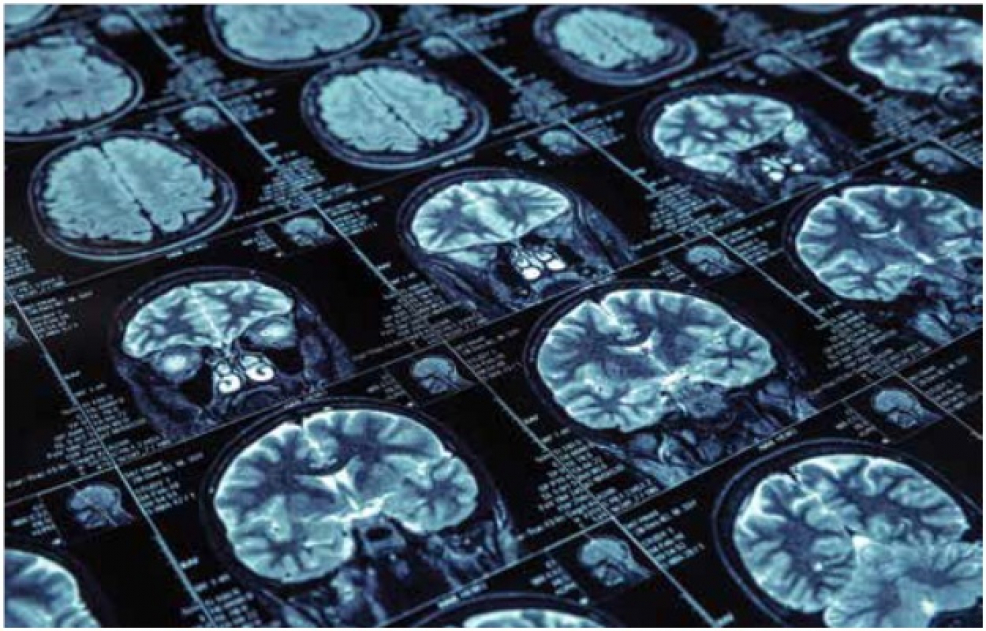 Cercetare & Inovare METROLOGIA PENTRU SĂNĂTATE